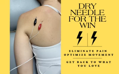 Dry needling therapy session featuring electrical stimulation on shoulder, emphasizing pain elimination and movement optimization.