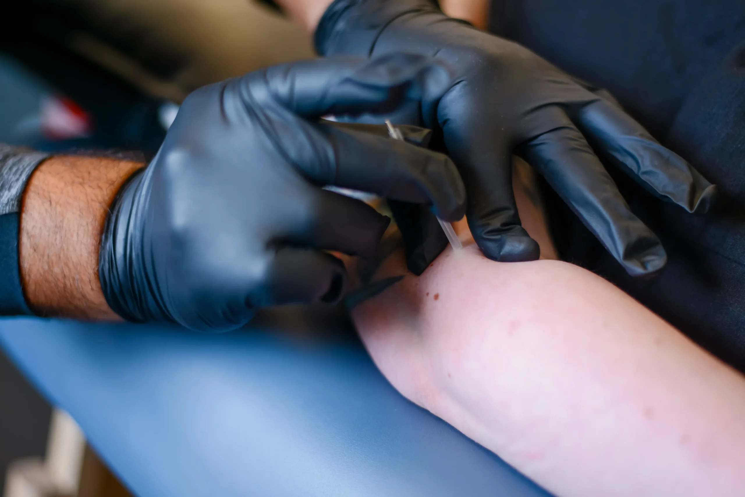 Dry Needling Kearney Missouri_11zon